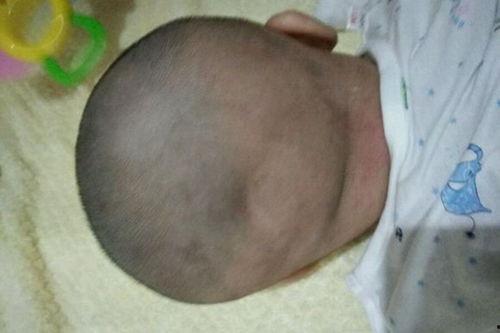 凹缝图片,揭秘自然界的神秘线条