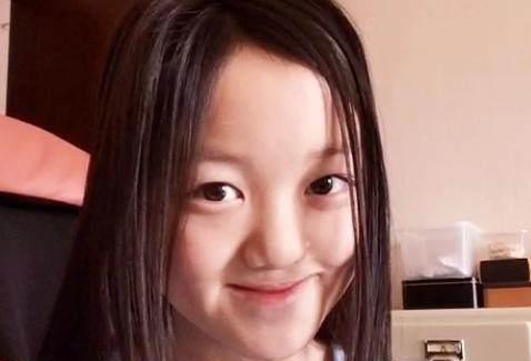 兔唇明星,兔唇明星的励志人生
