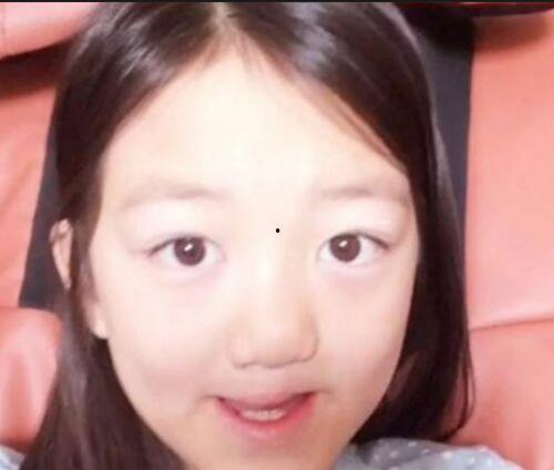 兔唇明星,兔唇明星的励志人生
